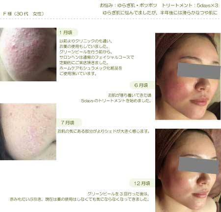 lohasbeauty